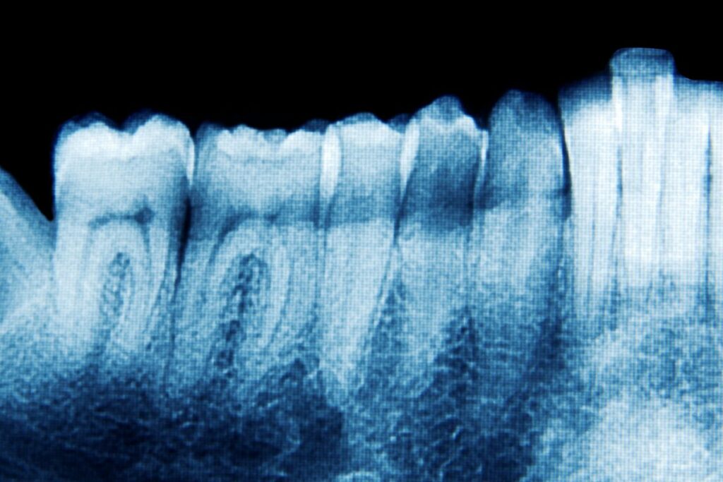 Quantos Dentes Temos na boca
