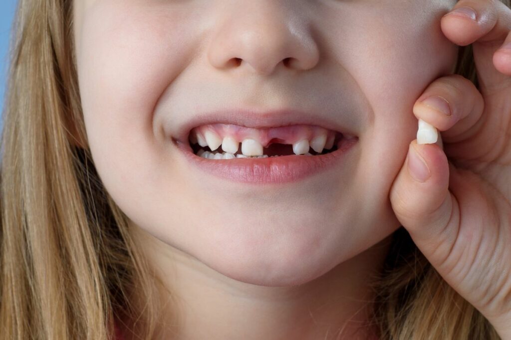 Quantos Dentes Temos na boca