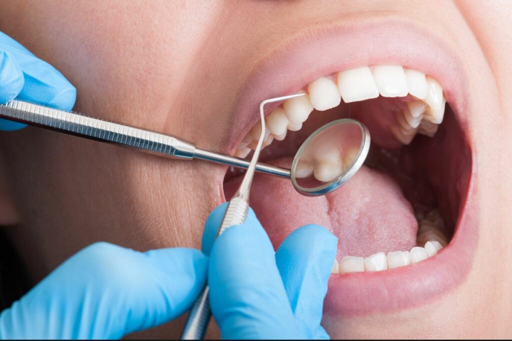 Quantos Dentes Temos na boca
